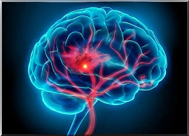 inflammation in the brain